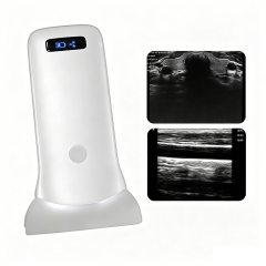 CProbe-5W Wireless Ultra-wide Linear Palm Doppler Ultrasound Pocket Ultrasound for Breast Hip Abdominal Muscle Examination