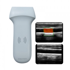 CProbe-8L Linear Palm Doppler Ultrasound Handheld Portable Medical Color Doppler MSK Venous Ultrasound Scanner