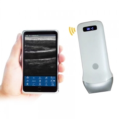 UProbe-3L Super Quality Linear Wireless Probe Type Palm B/W 7.5/10MHz Windproof Handheld Ultrasonic Diagnostic Device
