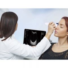 CProbe-4M Medical Doppler Probe Ophthalmology Newborns Eyes Ultrasound 8Mhz 11Mhz Micro Convex Palm Color Reusable