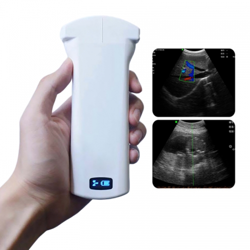 CProbe-6C 2in1 Palm Doppler Ultrasound Convex/linear Dual-head Wireless Probe Type Color Doppler Ultrasound Scanner