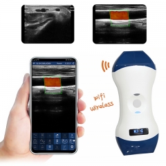 CProbe-5LP 2in1 Palm Doppler Color Doppler Electricity Powered Linear Probe Portable Ultrasound Scanner