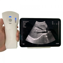 CProbe-8CPL Handheld 5CPL 3in1 Palm Color Doppler Ultrasound Convex Linear Phase Array Probe Ultrasound