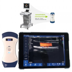 CProbe-5CL Wireless 2in1 Type B/W Palm Doppler Ultrasound, 128 element for Convex Center Phased Array or Linear Array