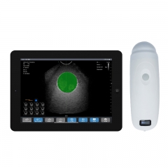 BProbe-5 Diagnostic Wireless Bladder Linear Convex Probe Price Ultrasound Scanner Machine Human