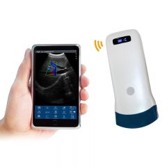CProbe-5C Hospital Medical Diagnostic Machine Device Portable Handheld Touch Screen 4C Convex Palm Color Doppler Ultrasound