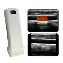 CProbe-6X Medical Equipment Handheld Mobile Wireless Scanner Accurate Puncture Linear Probe Type Ultrasound Scanner