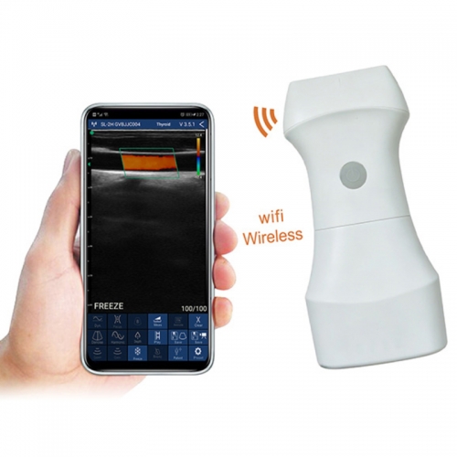 CProbe-9L Replaceable Battery Linear Probe 3D 4D Color Doppler Ultrasonido Machine Wireless Wifi Portable Ultrasound Scanner