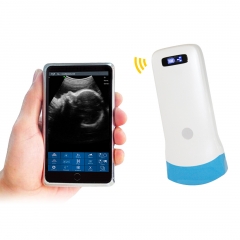 UProbe-5C Convex Palm B/W Ultrasound Wireless Probe Type B/W Ultrasound Scanner, 128 element