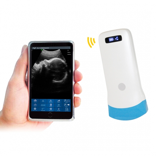 UProbe-5C Convex Palm B/W Ultrasound Wireless Probe Type B/W Ultrasound Scanner, 128 element
