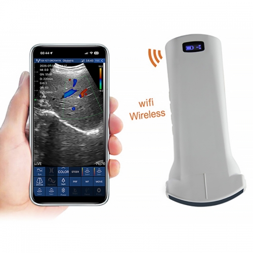 CProbe-6C Palm Portable Linear/Convex/Phased Array 3 in 1 Pocket Wireless Color Doppler Ultrasound