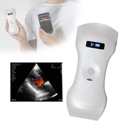 CProbe-6CPL 3in1 Palm Vascular Doppler Wireless Ultrasound Scan 10/12MHz 3.2/5Mhz Dual Head Linear Probe
