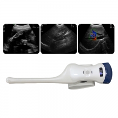CProbe-5CT Color Doppler Ultrasonic Diagnostic System Portable Pregnancy Tester Ultrasound Machine