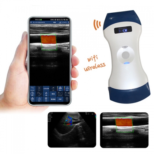 CProbe-5CL Wireless 2in1 Type B/W Palm Doppler Ultrasound, 128 element for Convex Center Phased Array or Linear Array