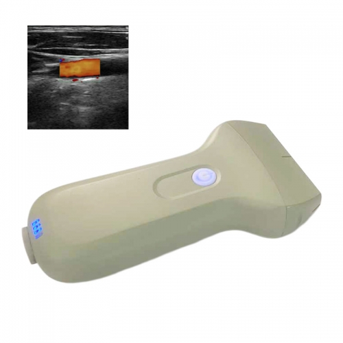 CProbe-3L Full Digital Ultrasound Imaging Diagnostic Device with Converx/linear/phased 3-in-1 Palm Doppler Ultrasound