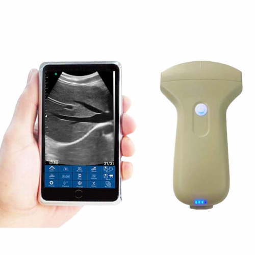 CProbe-3C Wireless Handheld Convex Linear 3-in-one Probe WiFi Type Mini B & Color Doppler Ultrasound Scanner