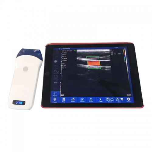 CProbe-5L Wireless Color Ultrasound Probe Scanner Linear USG Probes Smartphone Handheld Probe Ultrasound