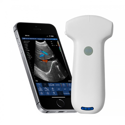 CProbe-8C Convex Palm Doppler Ultrasound Wireless Probe Type Color Doppler Ultrasound Scanner, 192 element