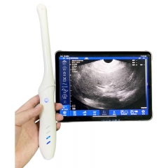 CProbe-4T Portable 4T Transvaginal Palm Doppler Ultrasound Pocket Probe USB Mode Ultrasound Scanner With 96 Elements on Sale