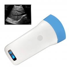 UProbe-5C Wireless High-Speed Clear Image Convex Head Portable Handheld Ultrasound Doppler Scanner Convex Probe