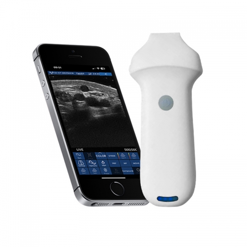CProbe-8S Linear Palm Doppler Ultrasound Type Wireless Scanner 96 Elements for Superficial Tissue Examination
