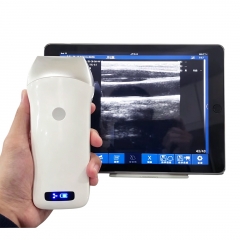 UProbe-3L Portable Laptop B/W Ultrasound Machine Price Full Digital Ultrasound Scanner