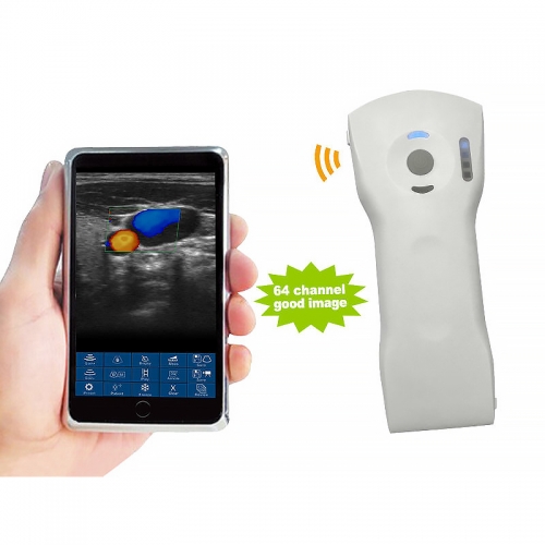 CProbe-8CPL 3-in-1 Wireless Handheld Ultrasound Handheld Color Palm Ultrasound Universal Palm Ultrasound