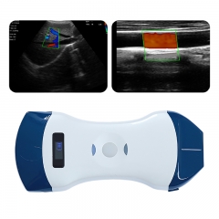 CProbe-5CP 2 in 1 Linear Convex Handheld Ultrasound Machine 2in1 Palm Doppler Ultrasound Scanner