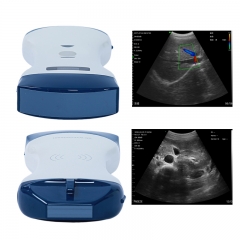CProbe-5CP 2 in 1 Linear Convex Handheld Ultrasound Machine 2in1 Palm Doppler Ultrasound Scanner