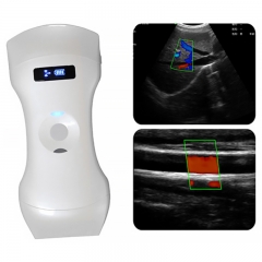 CProbe-6CPL Portable Convex/linear/phased Array 3 in 1 Palm Doppler Ultrasound Wireless Ultrasound Scanner Pocket Ultrasound
