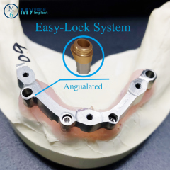 locator Easy-implant overdenture abutment attachment : Removable, support bar practice