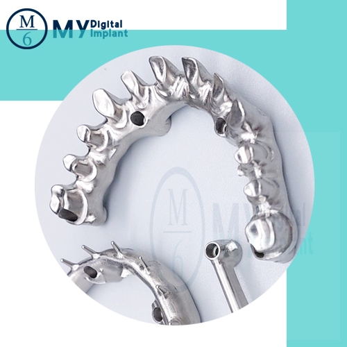 Puente de barra dental personalizado OEM, pilar de implante individual, modelo 3D, guía quirúrgica, diente temporal con impresora dental 3D y fresadora