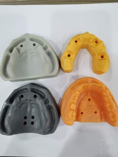 385nm 405nm 3D printer dental model resin surgical guide resin temporary tooth resin