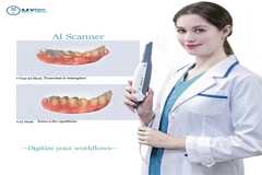 что такое цифровое стоматологическое сканирование?