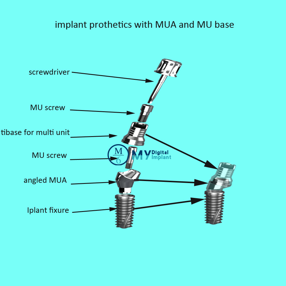 Zimmer compatible dental multi unit abutments