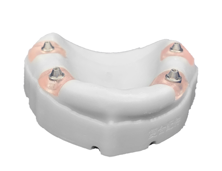 modelo dental impreso digitalmente