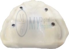 M6 digital dental analog for Duplo implant