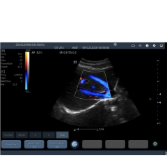 YSB363 Wireless color doppler ultrasound system connect WIFI