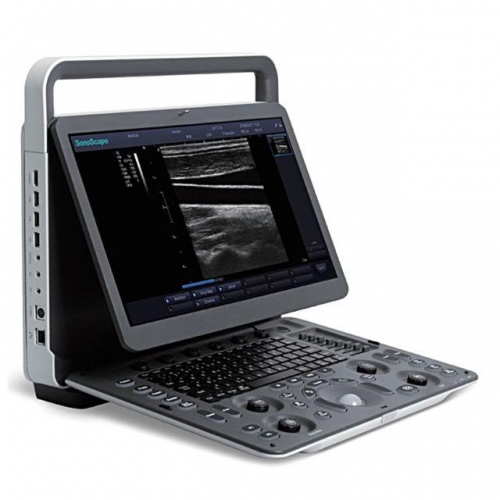 Sonoscape E1 PW Portable Black & White Ultrasound System