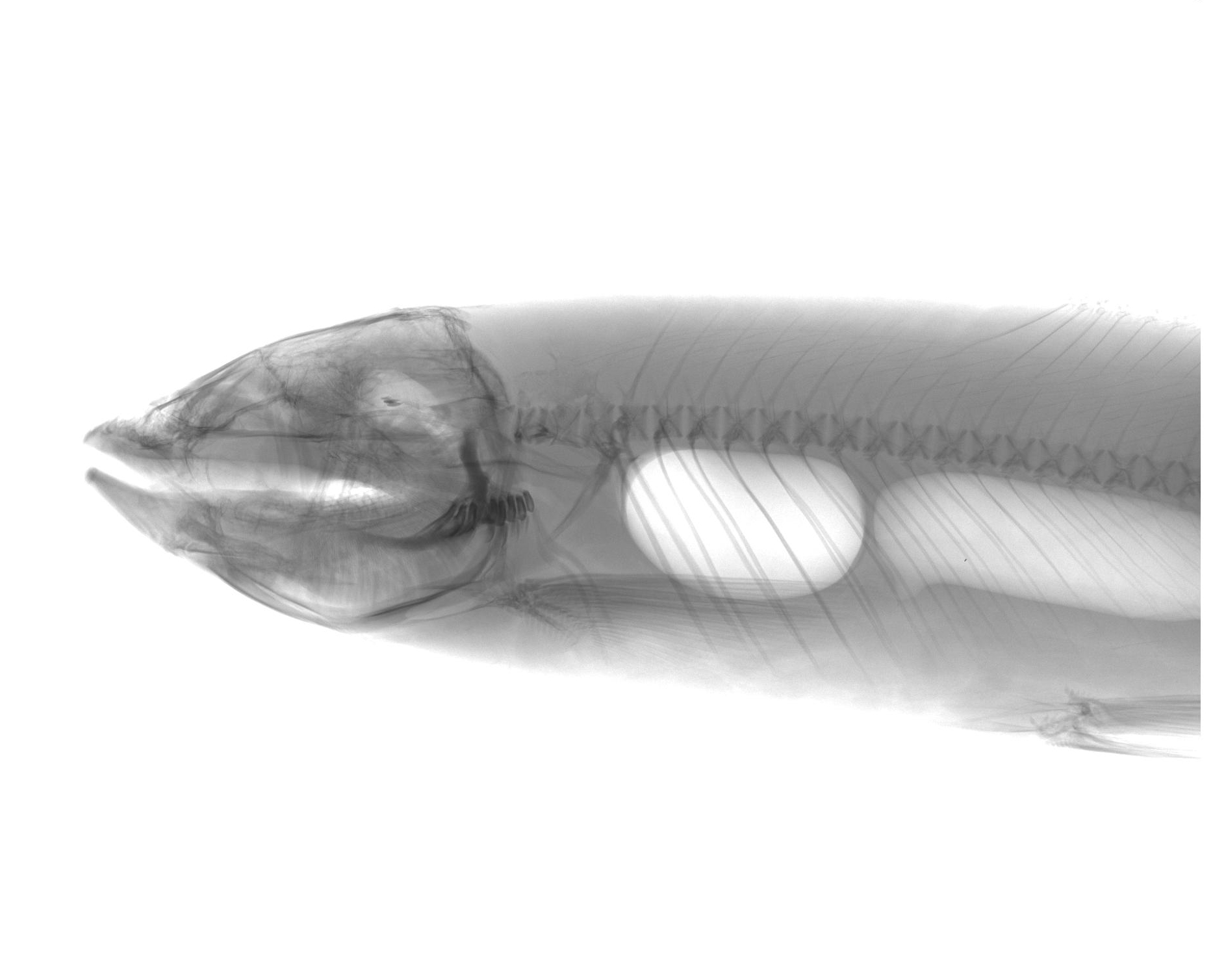 Image automatique de la machine à rayons X numérique