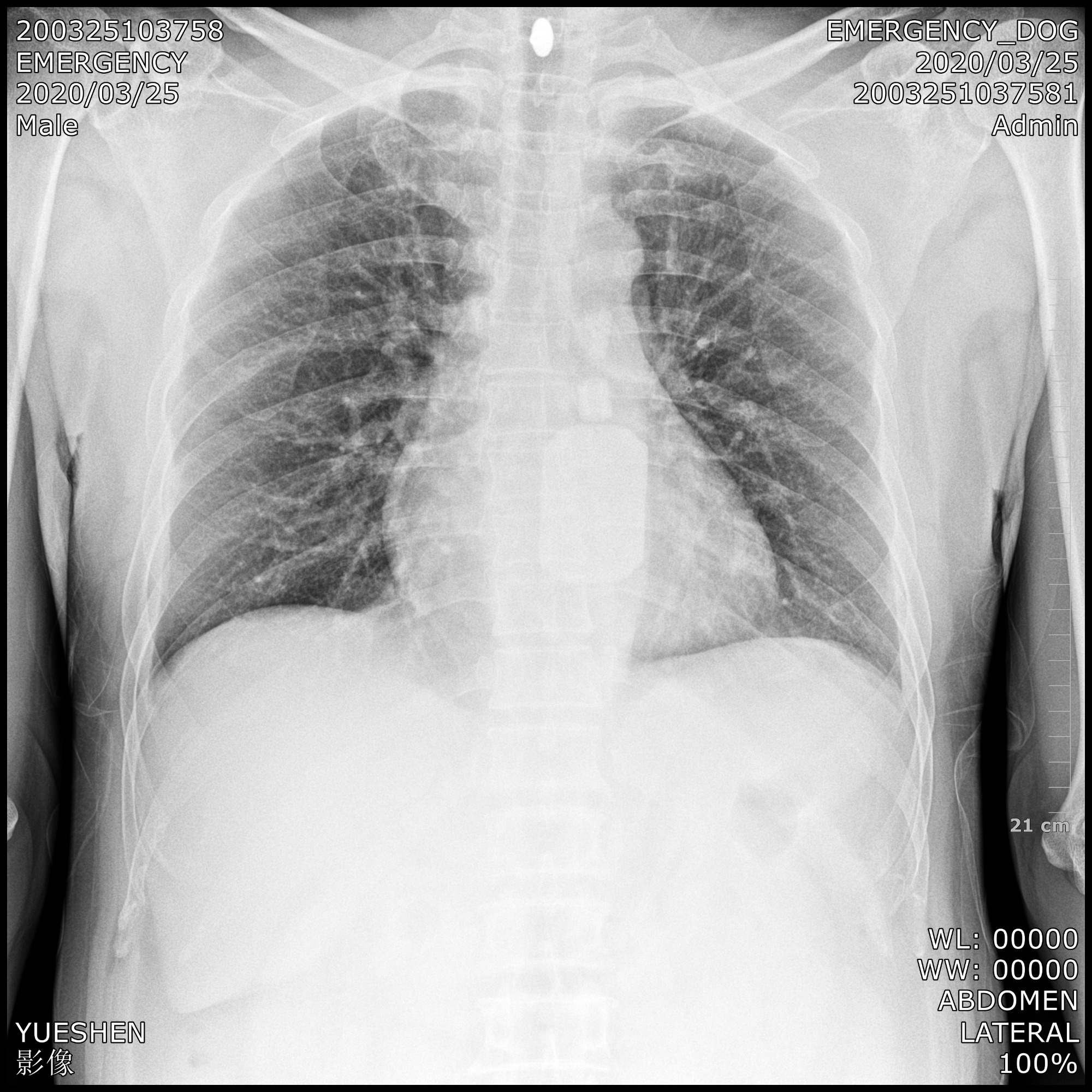 Automatic Digital X-Ray Machine Image