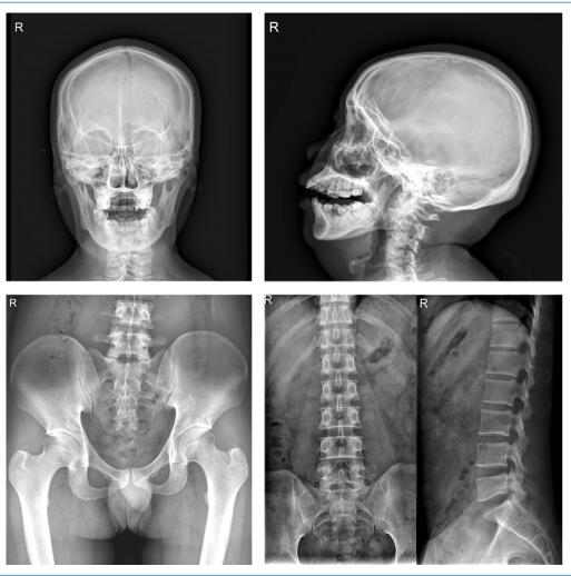 Imagen del sistema de rayos X médico digital