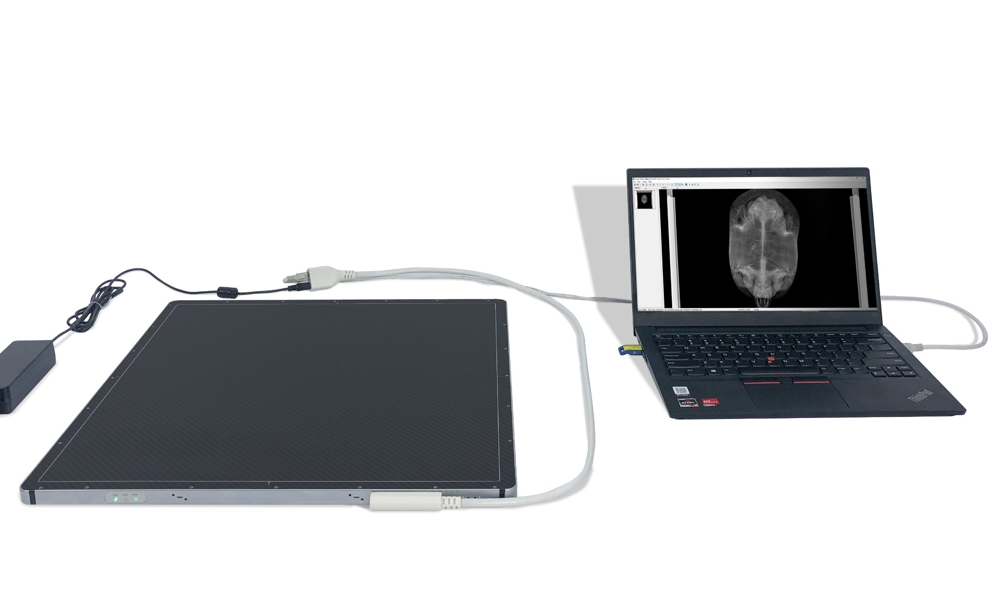 Automatic Digital X-Ray Machine Workstation