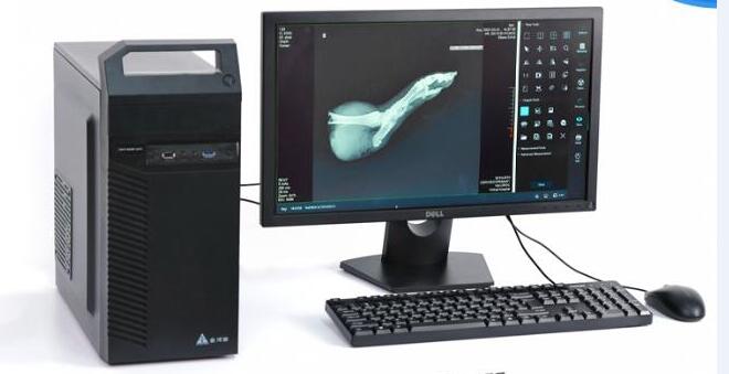 Automatic Digital X-Ray Machine Workstation