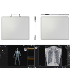 Wire/Wireless Flat Panel Detector for Digital X-ray Machine