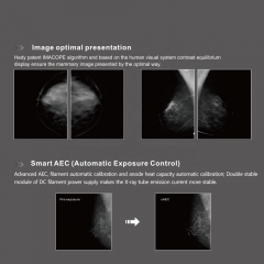 Equipo de imágenes del sistema de mamografía digital