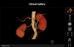 128 Slice medical computed tomography CT scanner