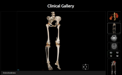 128 Slice medical computed tomography CT scanner