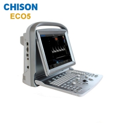 Полное цифровое УЗИ Отличное 3D 4D цветное допплеровское УЗИ Chison ECO5