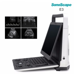 Sistema portátil del ultrasonido de Doppler del color de la máquina de ultrasonido de Sonoscape E2